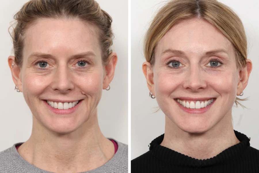 Best Aesthetic Clinic in Dubai for High-Quality Aesthetic Care