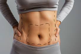 Transformative Results by the Best Liposuction Surgeons in Dubai